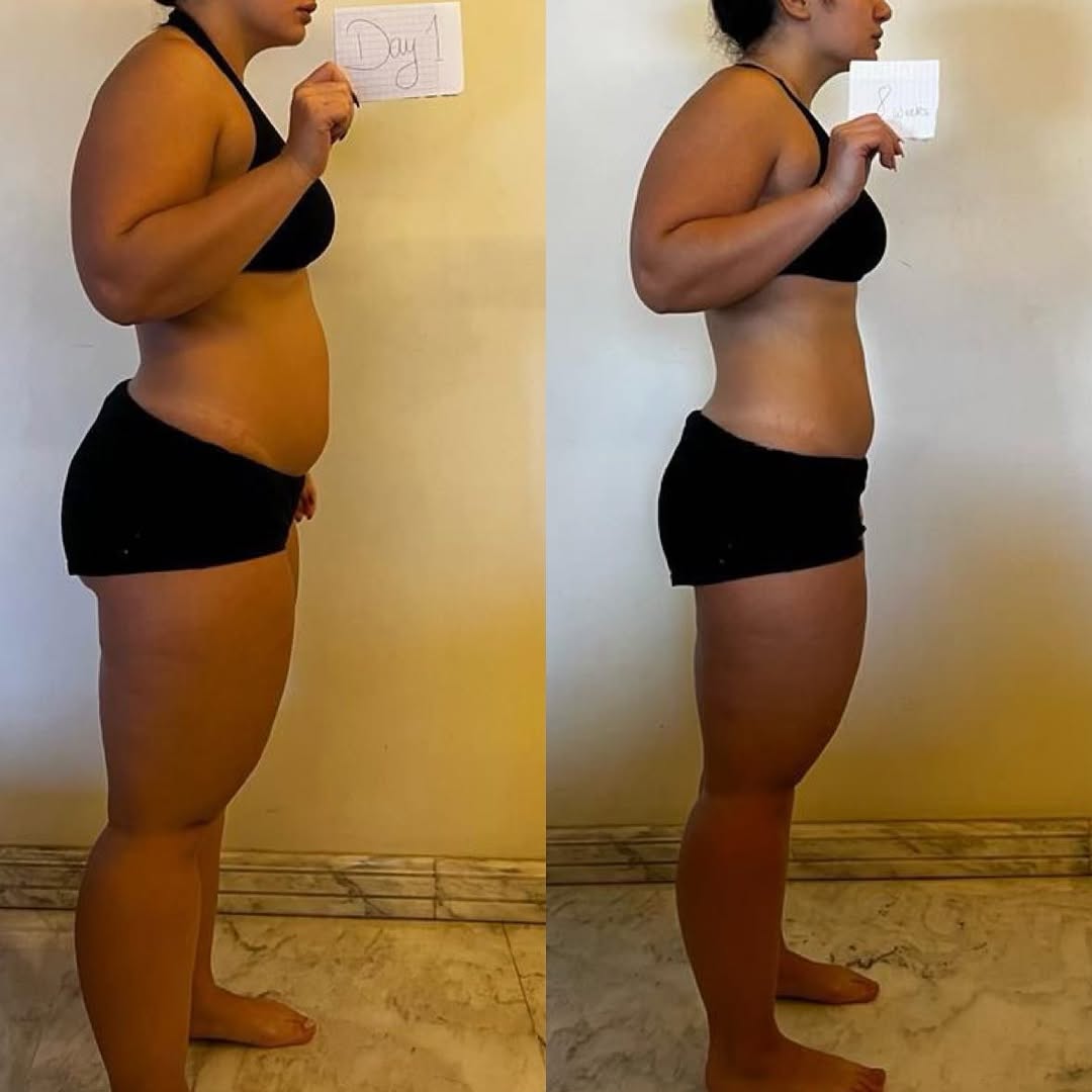 Weight Management Patches