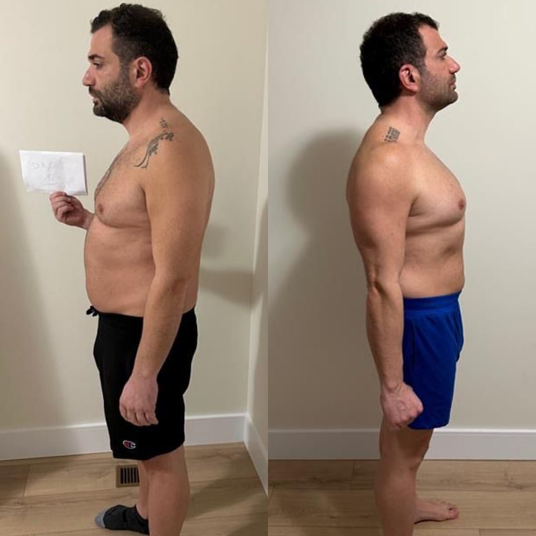 Weight Management Patches