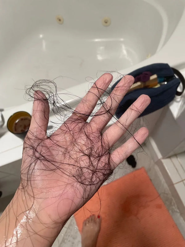 Moderate hair fall